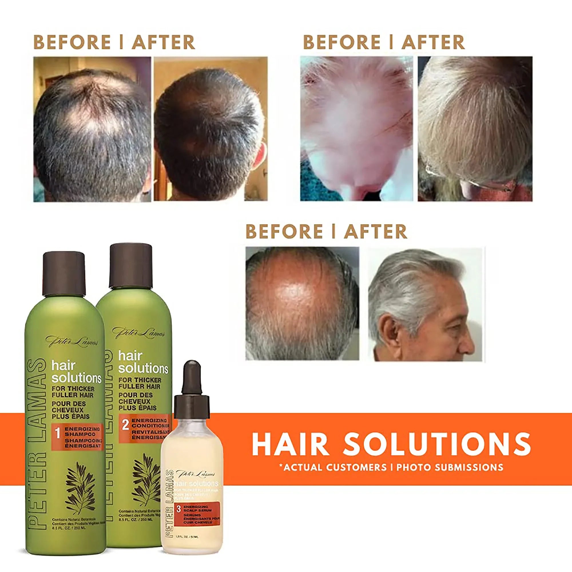 Hair Solutions - Hair Growth Energizing System | Peter Lamas
