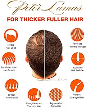 Hair Solutions - Hair Growth Energizing System | Peter Lamas