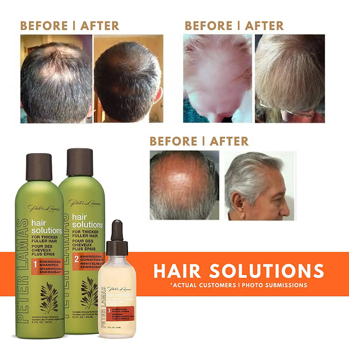 Hair Solutions - Hair Growth Energizing System | Peter Lamas